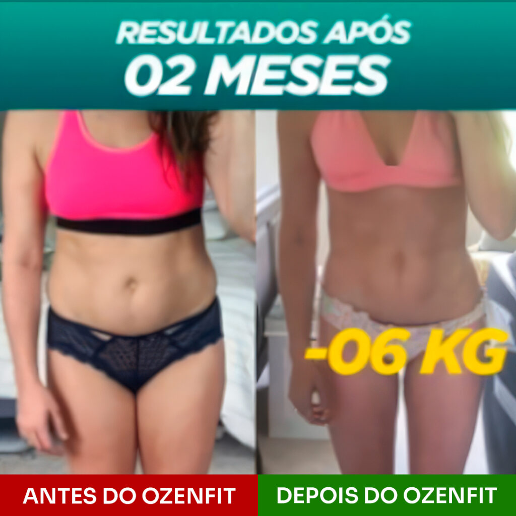 Antes e depois_Ana Carolina