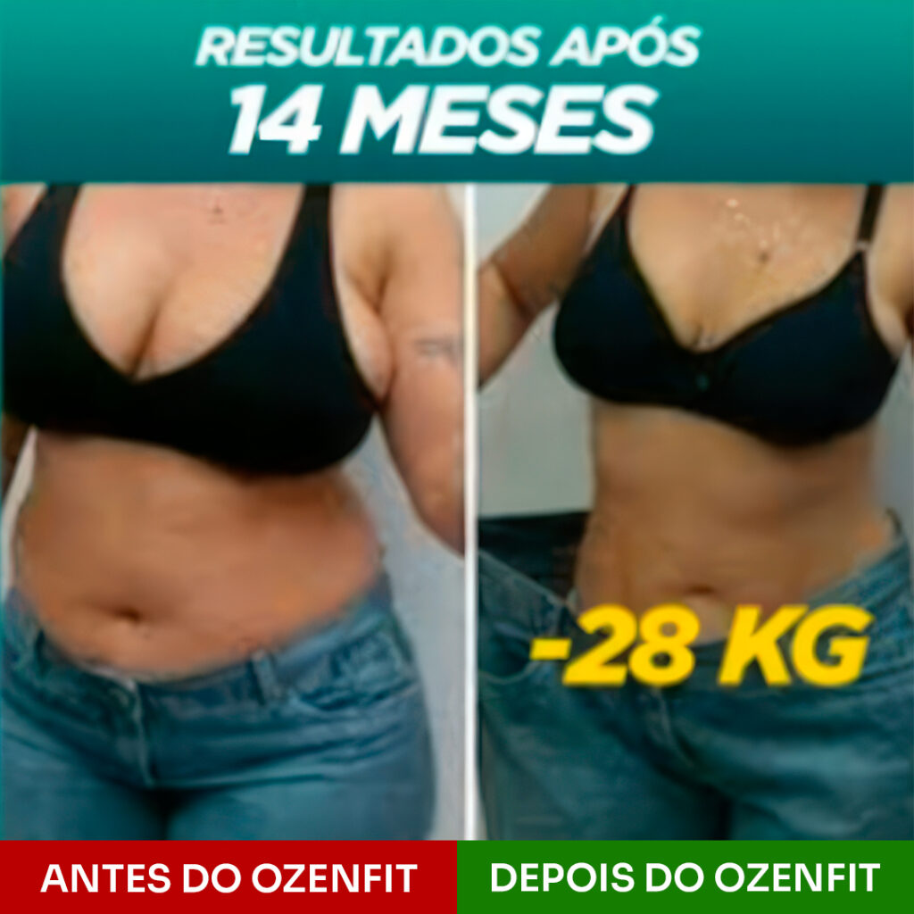 Antes e depois_Ana Maria