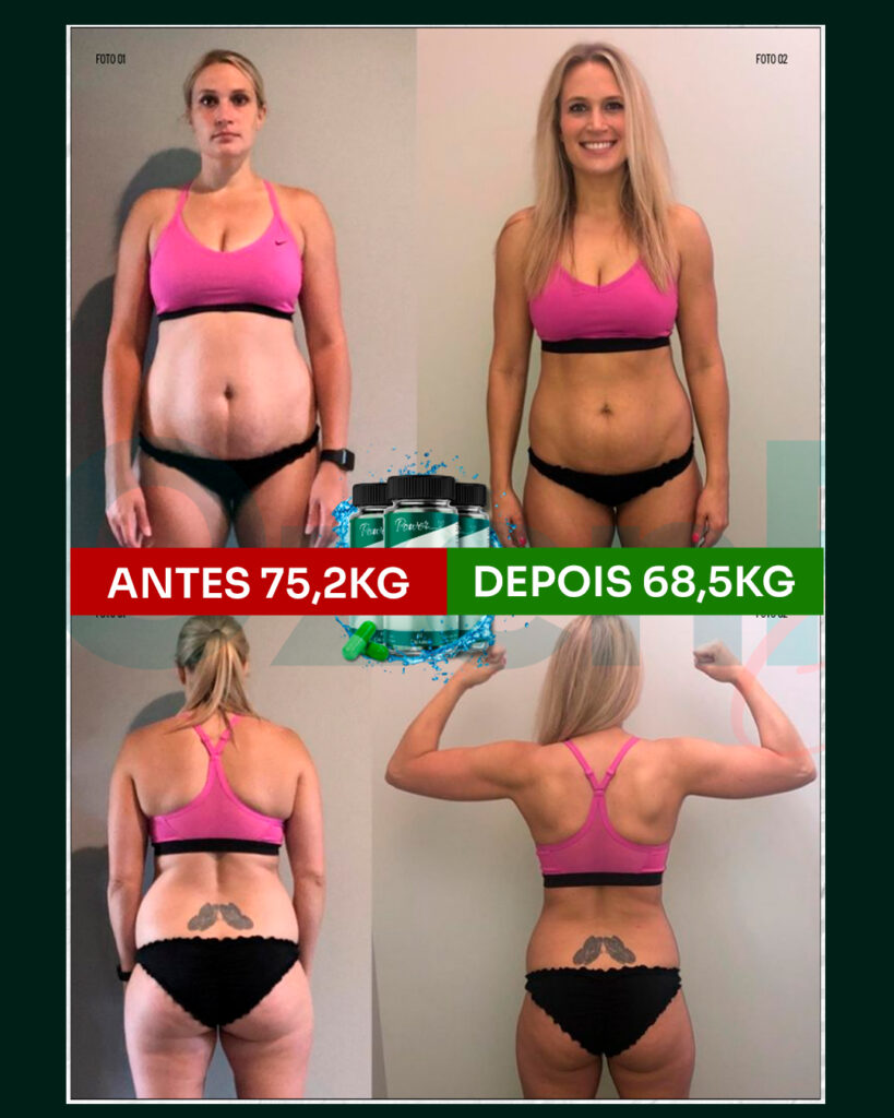 Antes e depois_Camila F Bauer