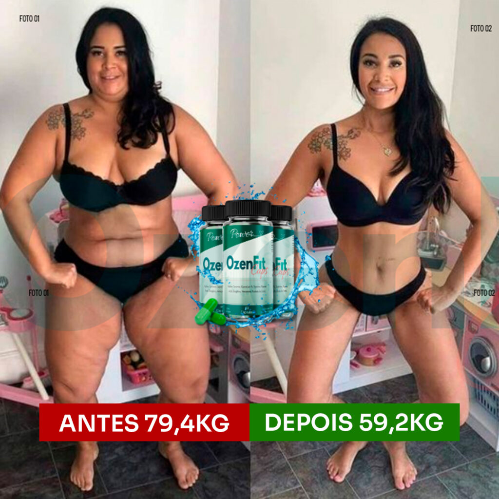 Antes e depois_Suelen M Arruda